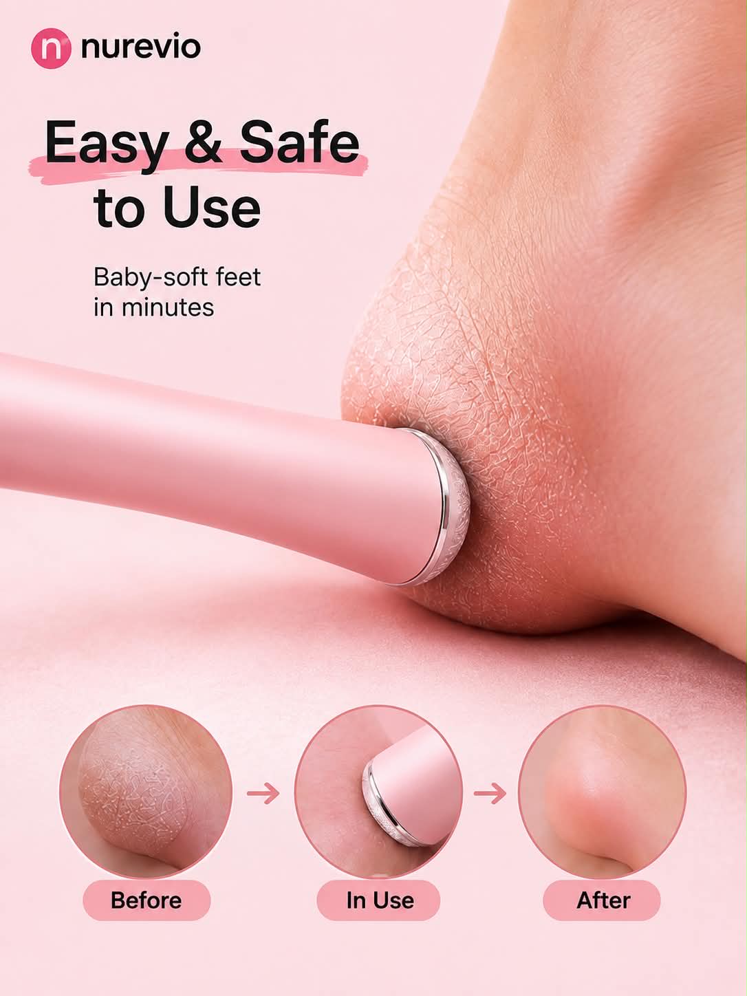 Electric Foot Callus Remover with 60 Included Sanding Discs